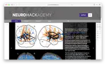 Neurohackademy Summer School in Neuroimaging and Data Science 2024